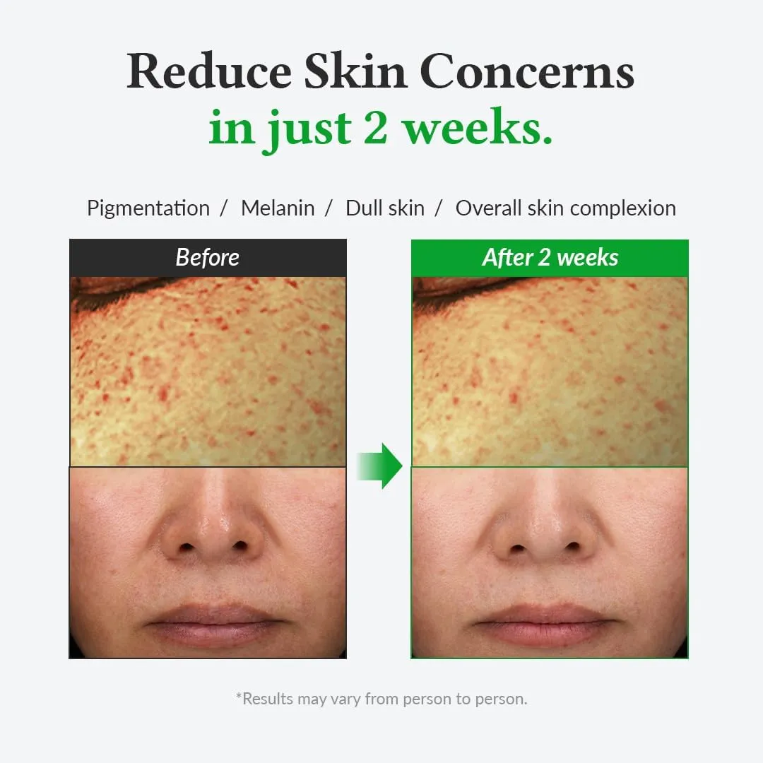 Dr.Althea Vitamin C Boosting Serum for All Skin Types