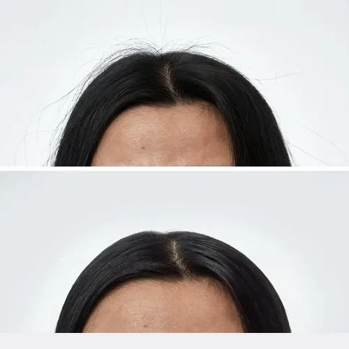 Smooth Hair Wand