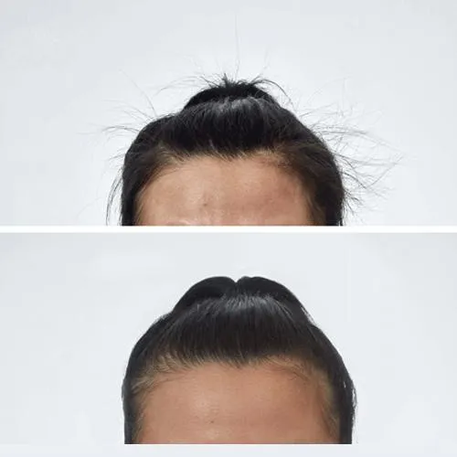 Smooth Hair Wand