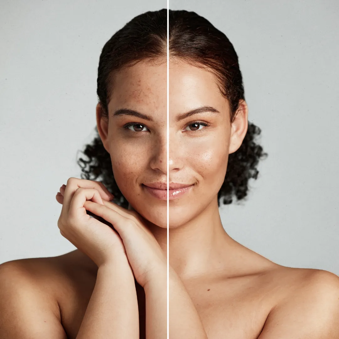 The Clean Skin Duo